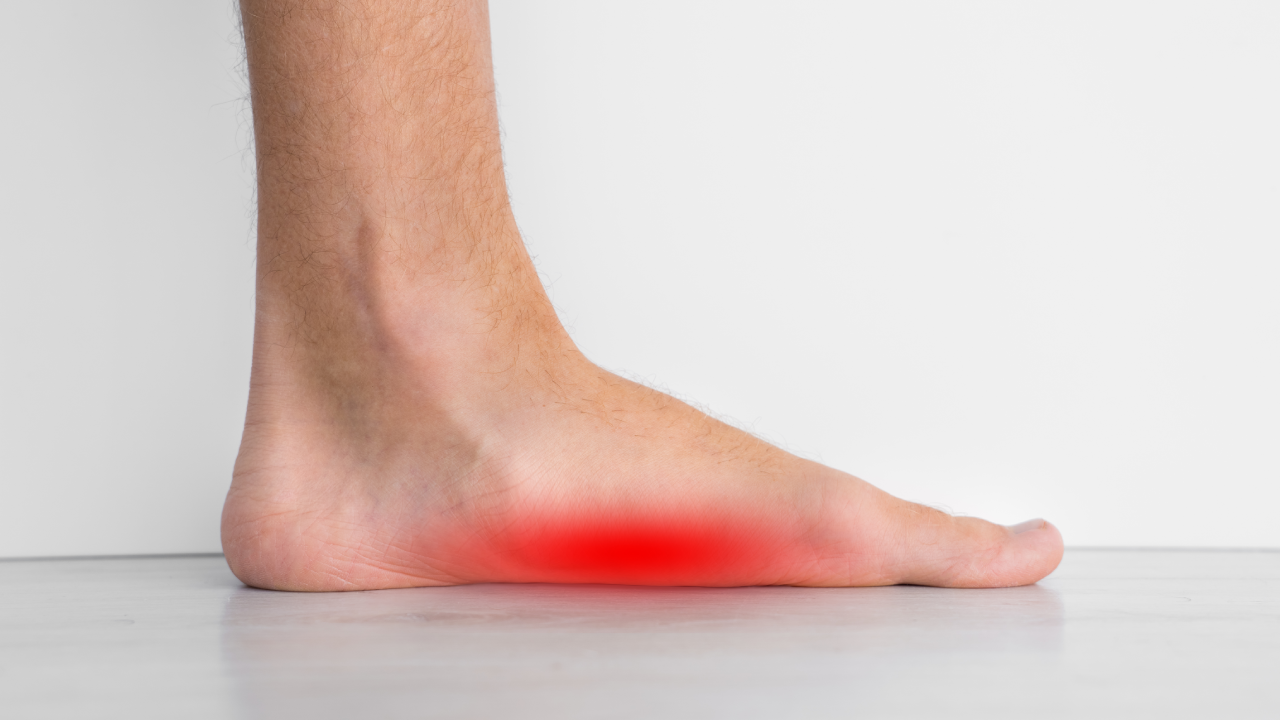 Flat Feet / Overpronation