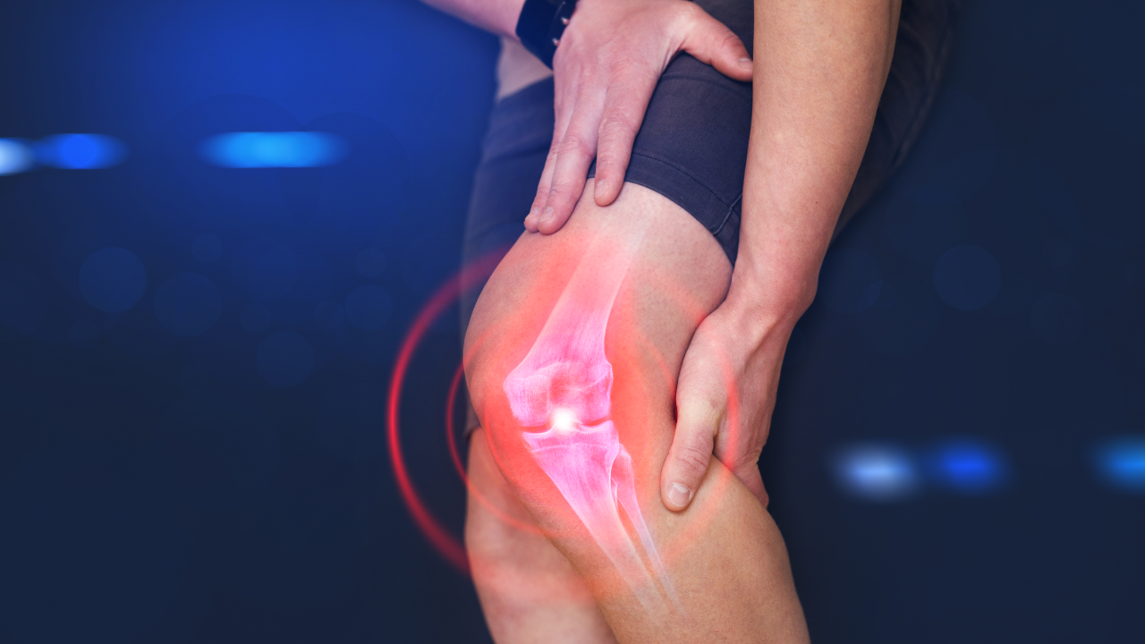 Knee Arthritis