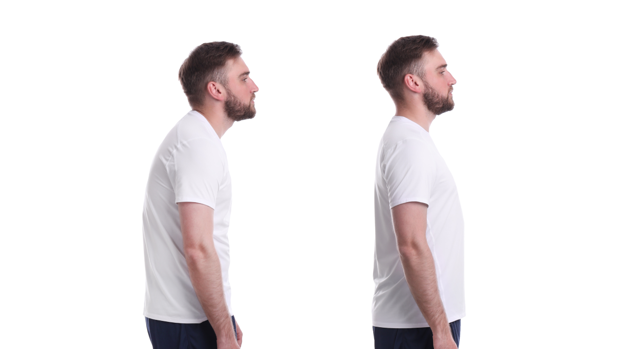 Poor Posture